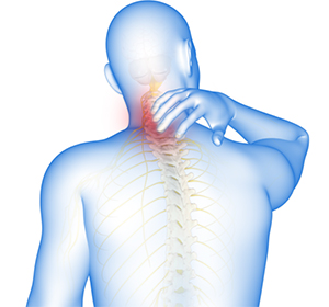 Cervical Spondylosis - Educational Picture