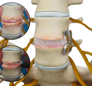 Spine - Educational Picture