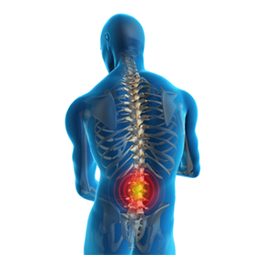 Low Back Pain - Educational Picture