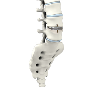Spine - Educational Picture
