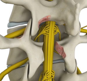 Spine - Educational Picture
