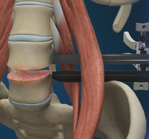 Spine - Educational Picture