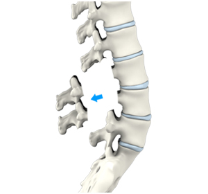 Spine - Educational Picture