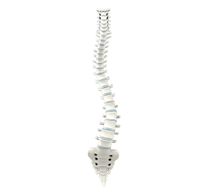 Scoliosis - Educational Picture
